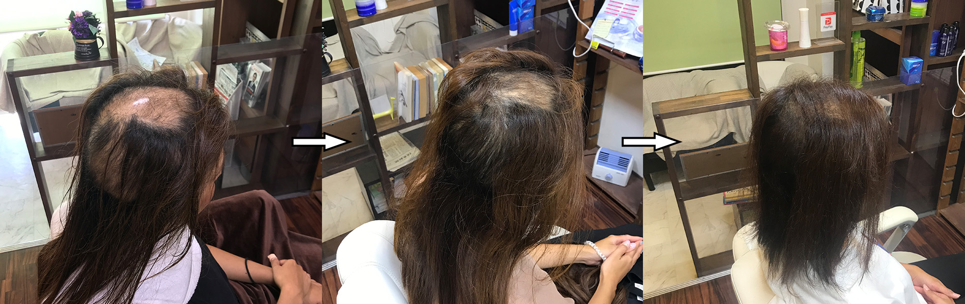 千葉抜毛症でお悩みの方へ ヘアーサロンever